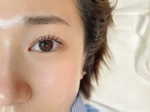 アリー(ALII)