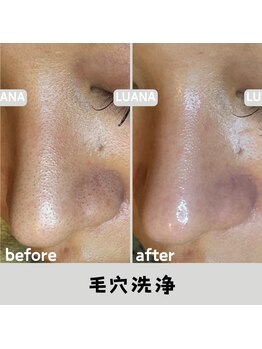 ルアナ 北谷店/毛穴洗浄毛穴ケア 《沖縄/北谷》
