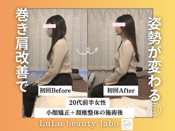 ルルラボ(LuLu beauty labo)/巻き肩改善で姿勢が激変