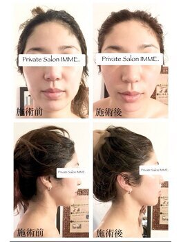 プライベートサロンイムエ(Private Salon IMME.)の写真/【初回】少し痛いけどくせになる!顔筋フェイシャル90分￥9900★たっぷりと丁寧にハンドトリートメント♪