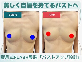 セブンシーズ 上野店(Seven Seas)の写真/【男性が豊かにバストアップ出来る理由】葉月式「科学的根拠に基づく」技術で内部から「構造変化」を狙う！
