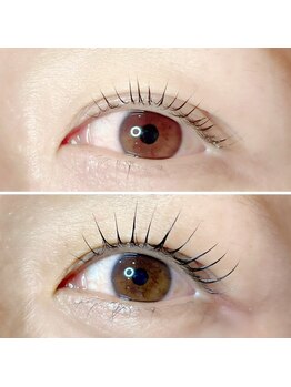 アブジー ヘア レボ(abbzi Hair Revo)/【MAI】まついく成功者