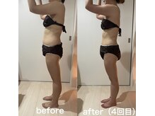 シャリテ(Charite)/しっかり効果を出す施術（痩身）