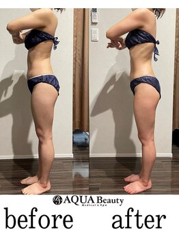 ビーエスアクアビューティー/全身リンパ