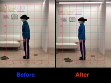 整体院 仁(JIN)/#O脚#X脚#股関節がつまる#臀部痛