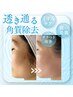【全顔WAX】シェービングは古い!断然フェイシャルワックス脱毛パック付¥7,500