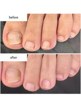 ケアプラス(care plus)/フットネイルケア