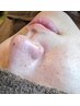 イチゴ鼻がスッキリ♪【メンズ】鼻+鼻毛WAX脱毛