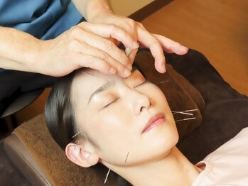 養美ラボ(YOBI Labo)/美容鍼