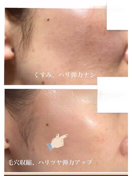 エムイーボーテ(me.Beaute)/【セルマン】ハリ艶アップ！