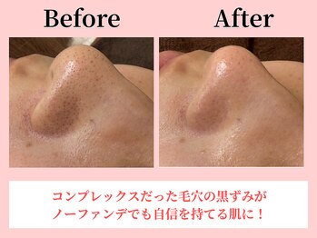 ココロ(COCORO)/美脳小顔矯正&毛穴洗浄