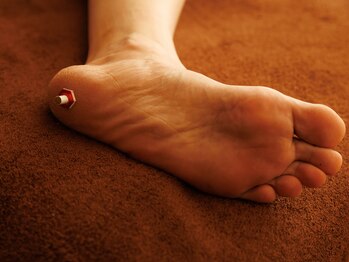 ととろはりきゅう院/不眠に