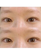 イロ(iro)/ラッシュリフト