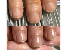 モアネイル 京都四条烏丸(More nail)の雰囲気（【自爪/深爪育成】深爪で悩んでいませんか？ネイルもできます♪）