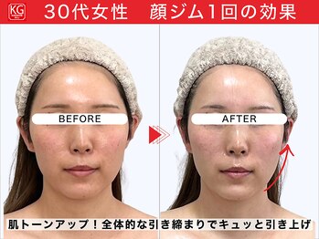 顔ジム 麻布店/顔ジム1回の効果