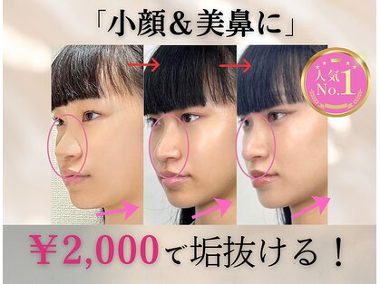 ラプリ 梅田店(Raplit)の写真