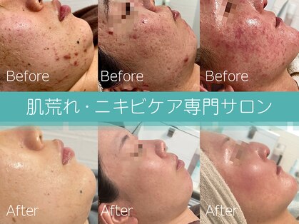 アンドナイン エス店(ANDNINE.)の写真