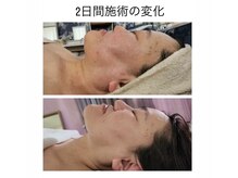 ミエリフル(Miel et Fleurs)の雰囲気（体重の変化はなし、頭の水分が抜けただけでこちらの結果。）