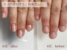 ウィッチ(witch)の雰囲気（ジェルをしながら憧れの美爪に＾＾コンプレックスはもう卒業！）
