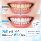 ホワイトニングショップ 宇都宮店