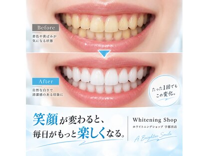 ホワイトニングショップ 宇都宮店の写真