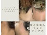 【ショートヘア・アップスタイリングされる方】うなじワックス特別価格¥3300