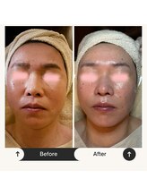 ボディケアサロン アイリフ(airef)/ビフォーアフター