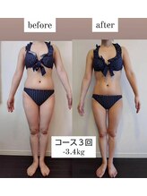 レナトゥス 銀座(Renatus)/3回Before&After【美脚/銀座】