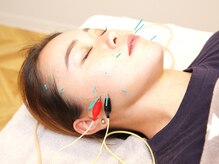 ネイビー鍼灸指圧治療院 那覇久米店(NAVY鍼灸指圧治療院)/美容鍼