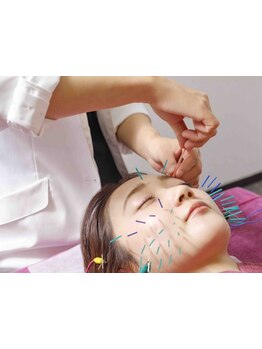 鍼灸施術を受けたい