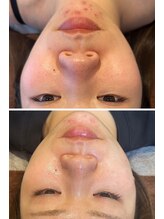 エムアイ 六本木(Mi)/