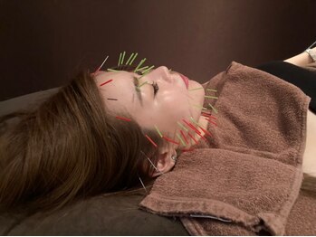 ルディア 堂島店(ledia)の写真/美肌効果はもちろん！肌トラブル改善にも！深部からお肌を綺麗にする力を呼び覚まします！