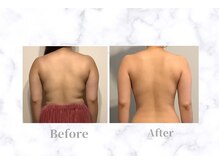 ふじこのきもち/20代のお客様「1回目～12回目」