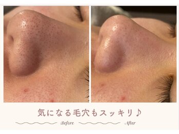 エステティックサロン シーズ/自己流ケアでは限界が・・・