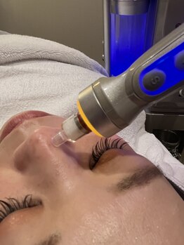 ビューティブロス(Beauty Bros)の写真/高濃度水素の肌洗浄で毛穴や黒ずみまで徹底洗浄★専門知識豊富なスタッフによる施術で効果を実感◎