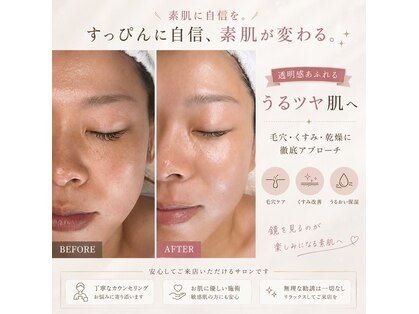 リベレ(Libelle)の写真