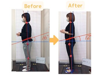 藤接骨院 浜松高林院/骨盤矯正で腰痛、痩身達成♪
