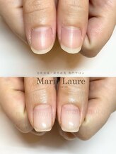 マリーロール 淀屋橋本店(Marie Laure)/自爪育成/深爪矯正/ネイルケア