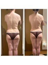 スリーアール(three R)/ビフォーアフター