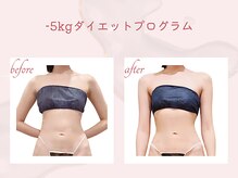 カド(Kado)の雰囲気（ダイエットならインディバ痩身のKadoへ！欲張りリンパもオイルも）