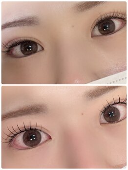 ココプラス(CoCoplus)/&Healthy（アンドヘルシー）