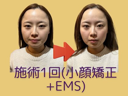 小顔矯正&美容整体サロン～VIAS～【ヴィアス】《小顔/むくみ/たるみケア》の写真