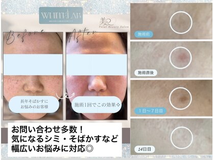 美Rの写真