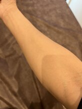 アレッド 大阪店(ared.)/人気メニュー腕脱毛