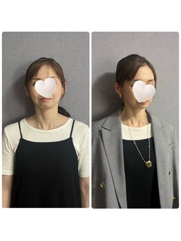 キラリナ/40代☆トータル診断