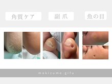 巻き爪補正店 金山店