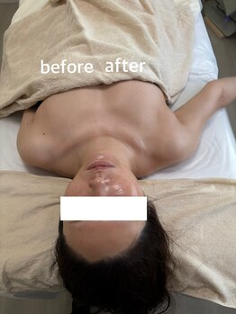 ラ セメリエ(La S'aimeriller)/首肩肩甲骨集中ケアリンパ