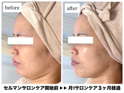 エムイーボーテ(me.Beaute)の写真