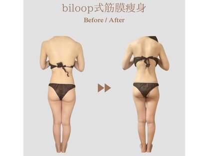 ビループ(biloop)の写真
