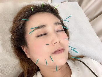 TK鍼灸院の写真/【体の内側から本質的に整える美容鍼】小顔ハリツヤUP。さらに全身を整え、内側から美しさを引き出します。